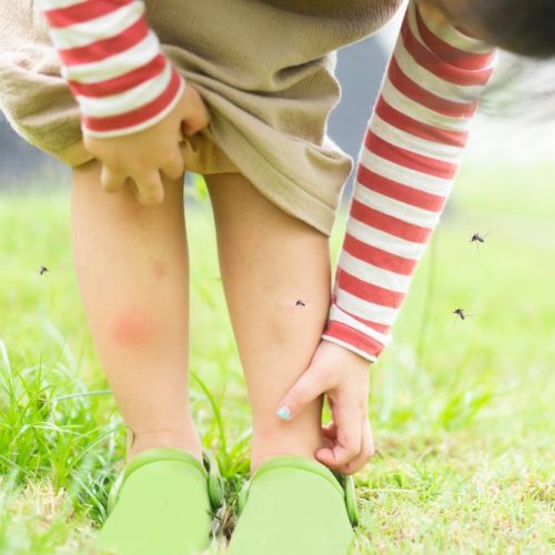 child outside scratching mosquito bites on her legs with mosquitos swarming around her